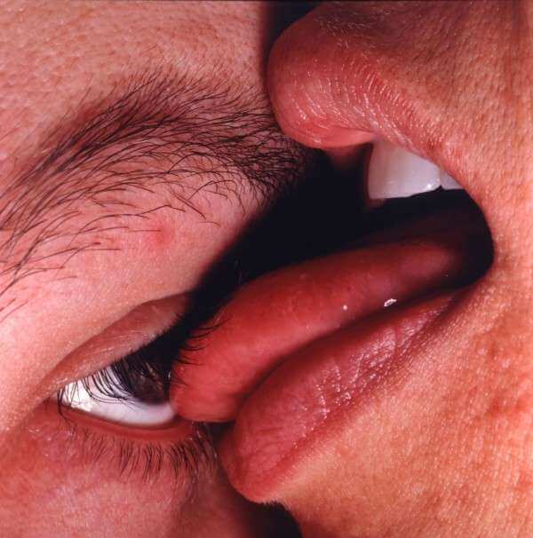 Eye